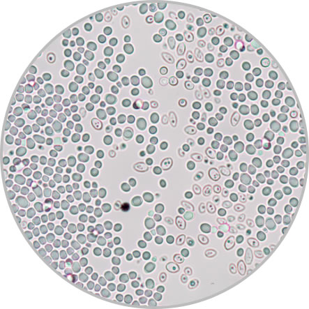 Yeast cells
